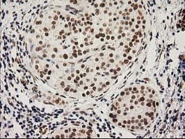 LOX / Lysyl Oxidase Antibody (clone OTI10D11)