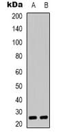 CYB561D1 Antibody (C-Terminus)
