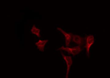 Polyclonal Rabbit anti-Human CLCC1 Antibody (IF, WB)