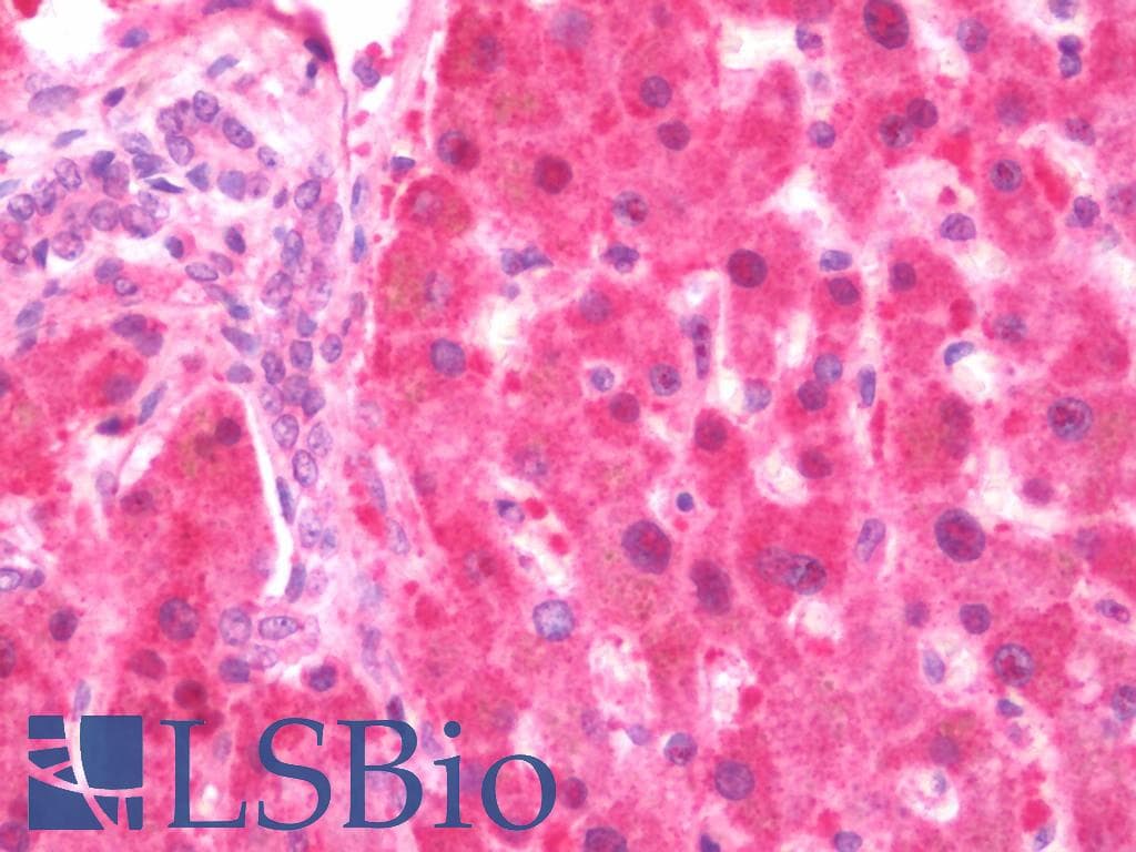 IHC-plus™ GDI2 Antibody