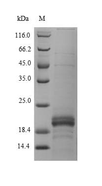 Human ZG16B Protein (Recombinant 6His, N-terminus)