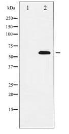 Polyclonal Rabbit anti-Human SOX9 Antibody (IHC, IF, WB)