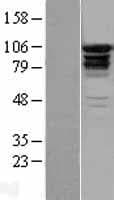 EPS15L1 / EPS15R Protein (Over-Expression Lysate Myc-DDK (Flag))