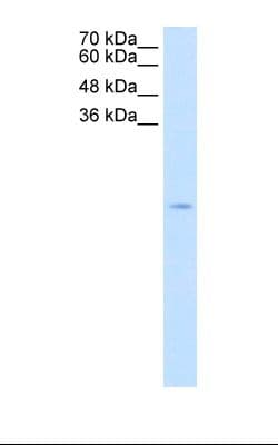 SOD1 / Cu-Zn SOD Antibody (N-Terminus, Biotin)
