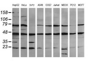 MAP2K1 / MKK1 / MEK1 Antibody (clone OTI2H3, Carrier-free)