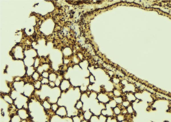 FOXO1 / FKHR Antibody