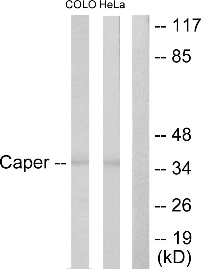 ATP6AP2 / Renin Receptor Antibody (aa171-220)