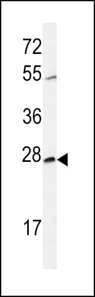CWC15 Antibody (aa123-152)
