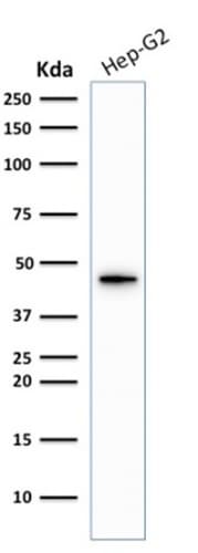 KRT19 / CK19 / Cytokeratin 19 Antibody (clone KRT19/1959R)