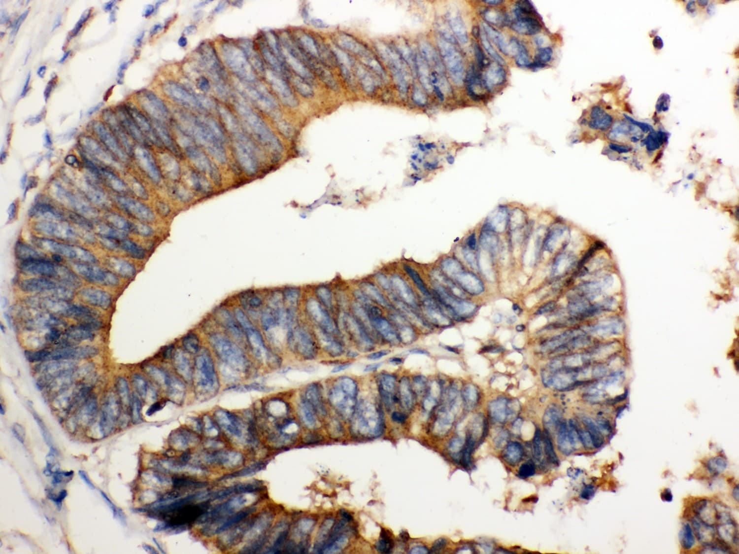 NMI Antibody (aa2-307)