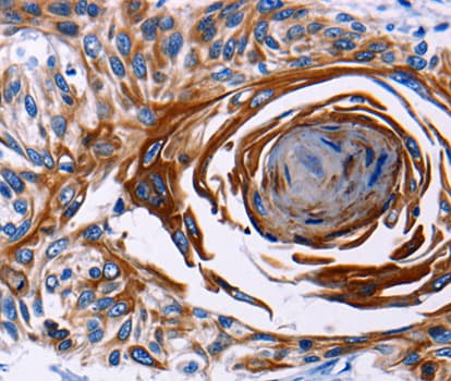 CDw218a / IL18R1 Antibody