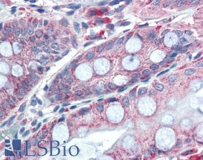 PathPlus™ Polyclonal Rabbit anti-Mouse GREM1 / Gremlin-1 Antibody (aa26-184, IHC, WB)