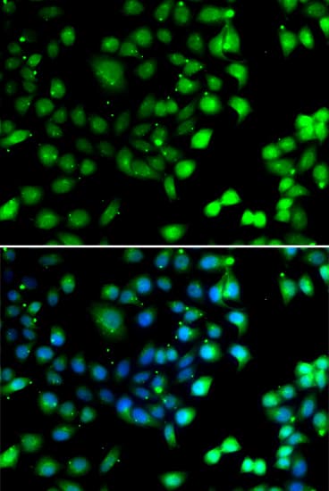 NTMT1 / C9orf32 Antibody