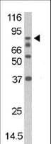 Polyclonal Rabbit anti-Human DAXX Antibody (phospho-Ser213, IHC, WB)