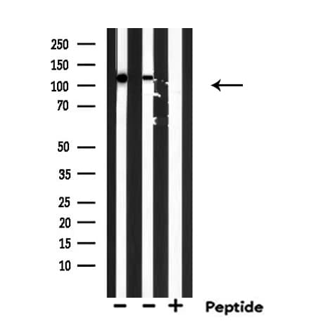 EIF5B / IF2 Antibody