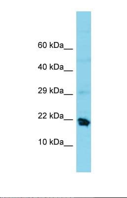 Polyclonal Rabbit anti-Human MRPS25 Antibody (C-Terminus, WB)