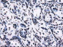 RPA2 / RFA2 / RPA34 Antibody (clone OTI7C12)