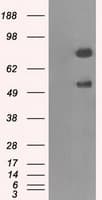 GBE1 Antibody (clone OTI4A1)