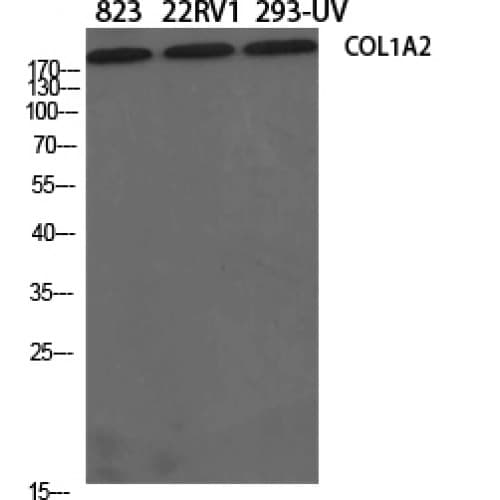 COL1A2 / Collagen I Alpha 2 Antibody (1-80 aa, N-terminal)