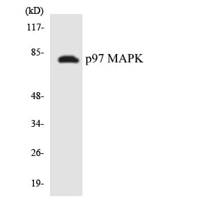MAPK6 / ERK3 Antibody (aa136-185)