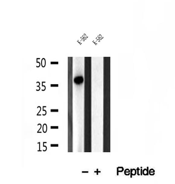 Polyclonal Rabbit anti-Human SGTA / SGT Antibody (IHC, WB)