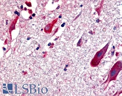 PathPlus™ ADGRG6 / GPR126 Antibody (C-Terminus)