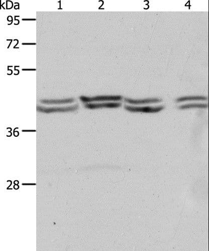 Polyclonal Rabbit anti-Human PSMD6 Antibody (IHC, WB)