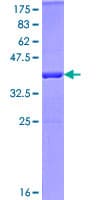 Human PELI1 / Pellino 1 Protein (Recombinant GST)