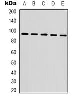 IHC-plus™ Monoclonal Mouse anti-Human CTNNB1 / Beta Catenin Antibody (IHC, WB)