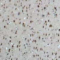 CASR/Calcium Sensing Receptor Antibody