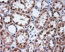 PTPRE / PTP Epsilon Antibody (clone OTI3H8)