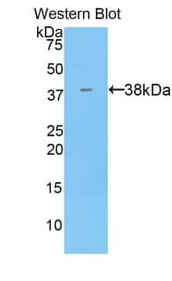 KRT71 / Keratin 71 Antibody (aa132-440, Biotin)
