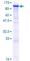 Human ZP2 Protein (Recombinant GST)