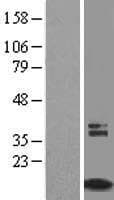 TIMM8A Protein (Over-Expression Lysate Myc-DDK (Flag))