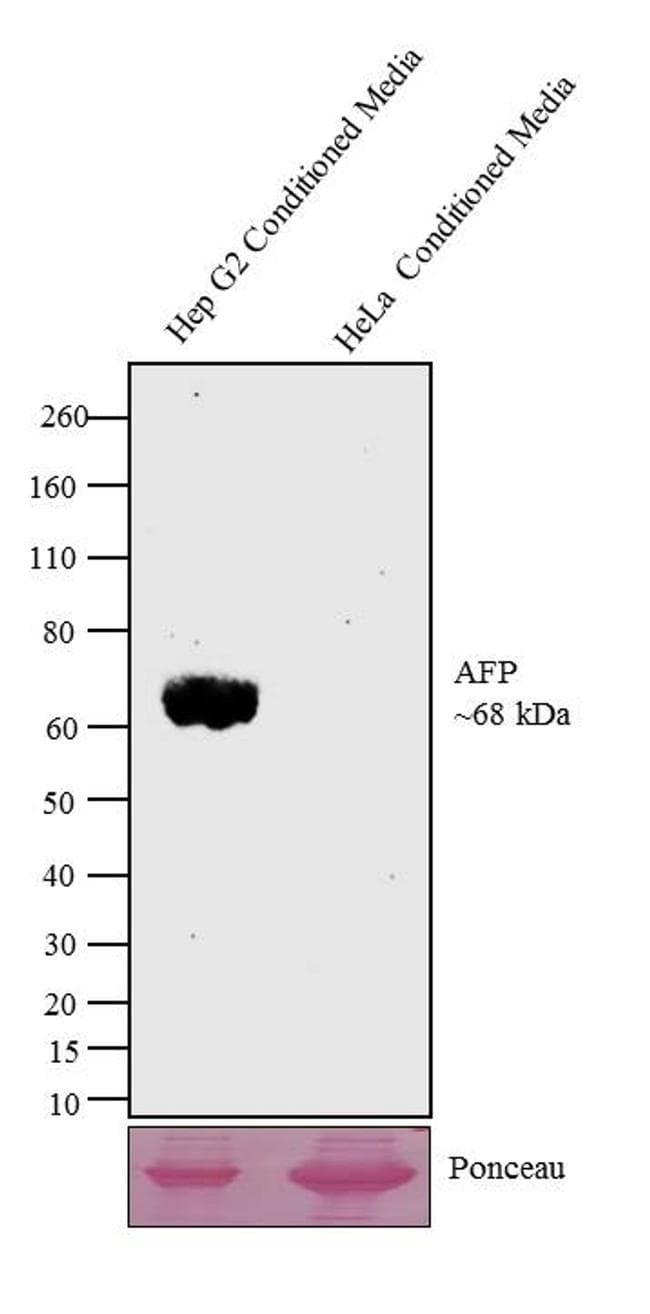 Alpha-Fetoprotein Antibody (clone AFP-01)