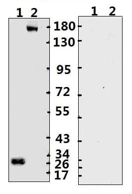 SARS-CoV-2 Spike Glycoprotein Antibody (Extracellular Domain - ECD)