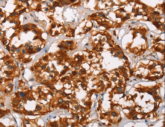 Polyclonal Rabbit anti-Human ADNP Antibody (IHC)