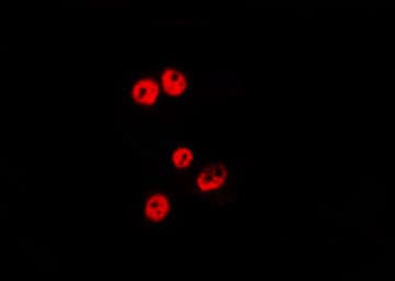 Polyclonal Rabbit anti-Human RBBP5 Antibody (IF, WB)