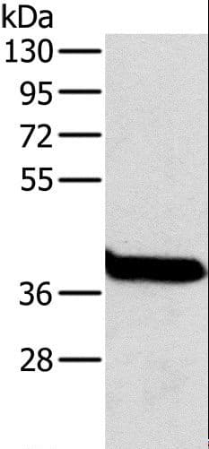 Polyclonal Rabbit anti-Human OTC Antibody (IHC, WB)