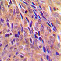 CHUK / IKKA / IKK Alpha Antibody (phospho-Thr23)
