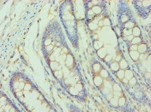 SMYD3 Antibody (aa199-428)