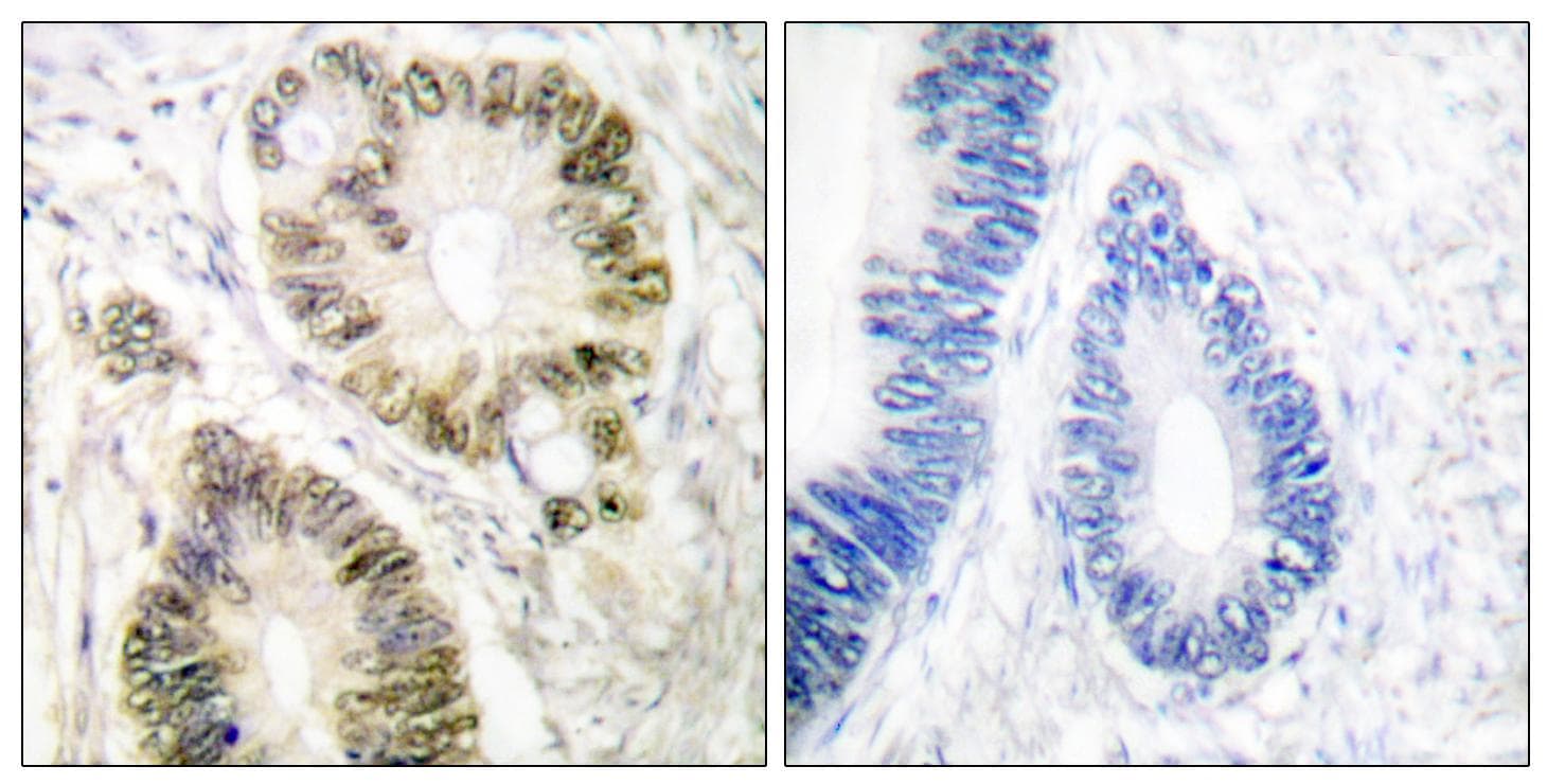 CCNE1 / Cyclin E1 Antibody (phospho-Thr395)