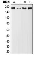 EMA / MUC1 Antibody (phospho-Tyr1229)