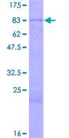 Human NOP58 / NOP5 Protein (Recombinant GST)