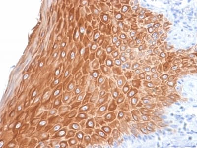 Recombinant Monoclonal Rabbit anti-Human KRT16 / CK16 / Cytokeratin 16 Antibody (clone KRT16/2043R, C-Terminus, IHC)