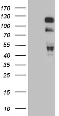 MAPT / Tau Antibody (aa623-758, clone OTI6G3)