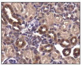 SLC2A4 / GLUT-4 Antibody (aa480-509)