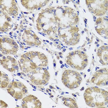 CTSC / Cathepsin C / JP Antibody