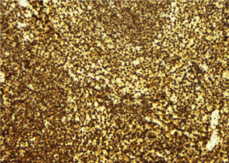 PDIK1L Antibody
