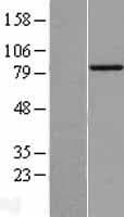 BBS2 / BBS Protein (Over-Expression Lysate Myc-DDK (Flag))